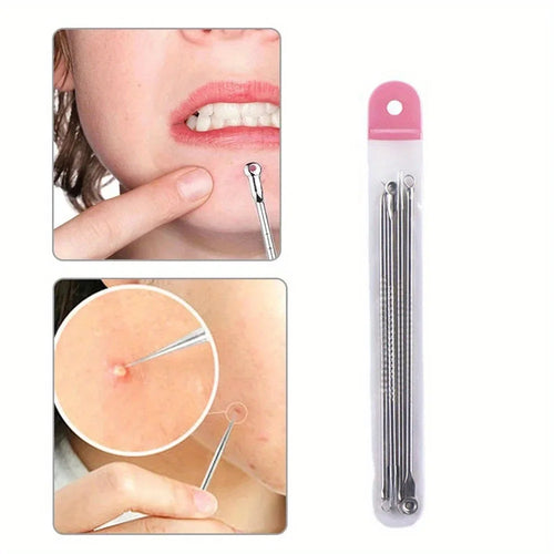 4-in-1 Blackhead & Acne Extractor Kit